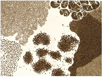 Microcystis-Cyanobakterien-Taihu-Teubner